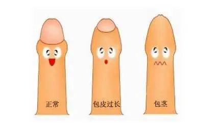 小弟弟上长了“小点点”，是性病吗？(图18)