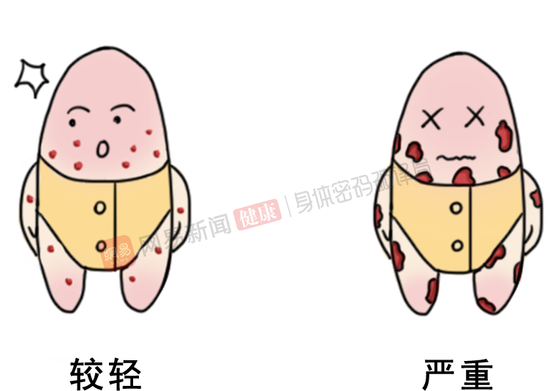 小弟弟上长了“小点点”，是性病吗？(图19)