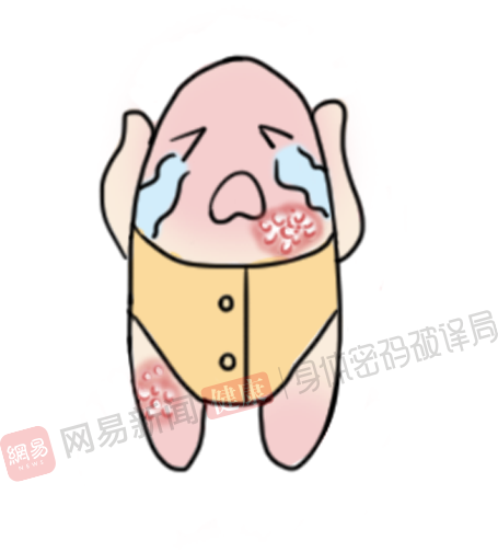 小弟弟上长了“小点点”,是性病吗?(图21) 小弟弟上长了“小点点”,是性病吗?(图21)